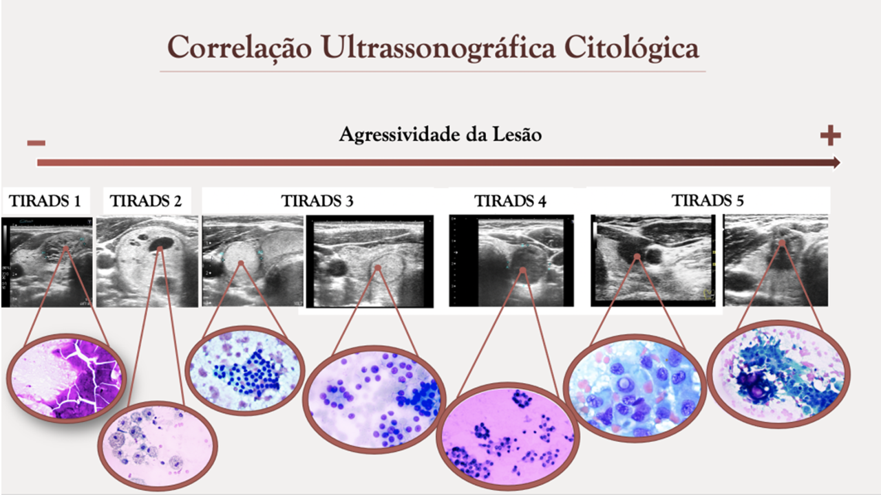tirads fig1.png