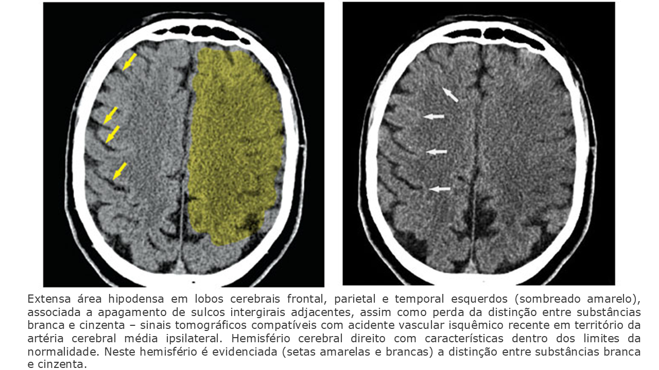 imagem tc ave.png imagem tc ave.png