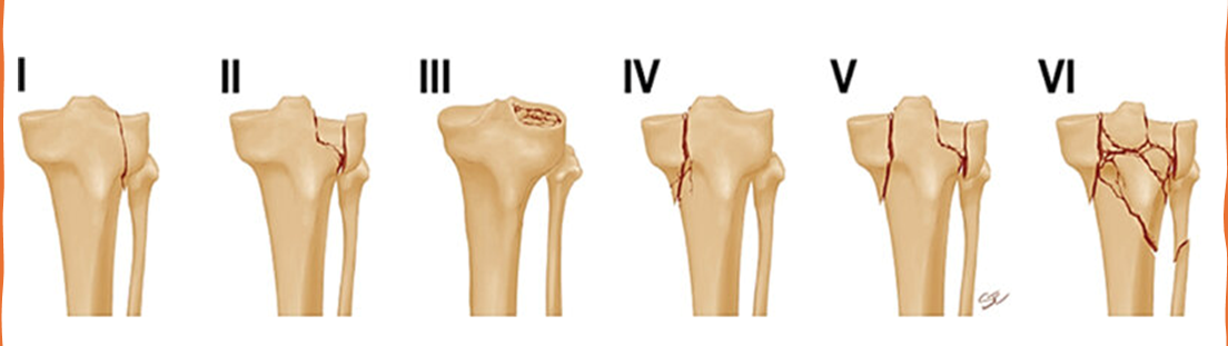 clas schalstker1.png