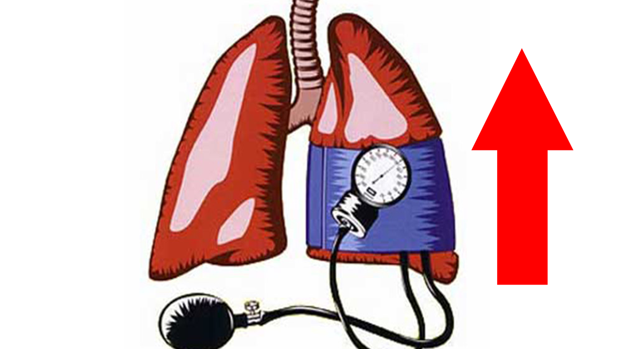 HIPE PULMONAR.png