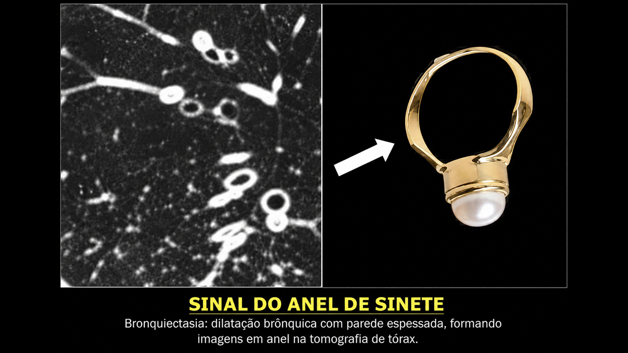 aneldosinetee.png