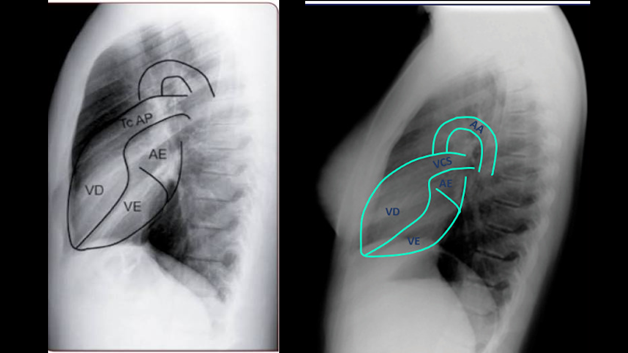 radiografia deperfil11.png