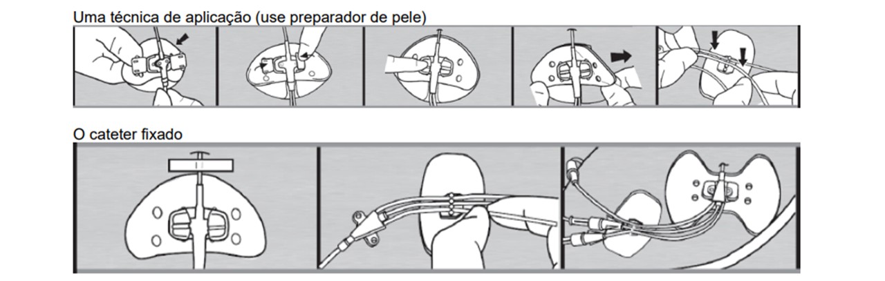 fix picc2.jpg