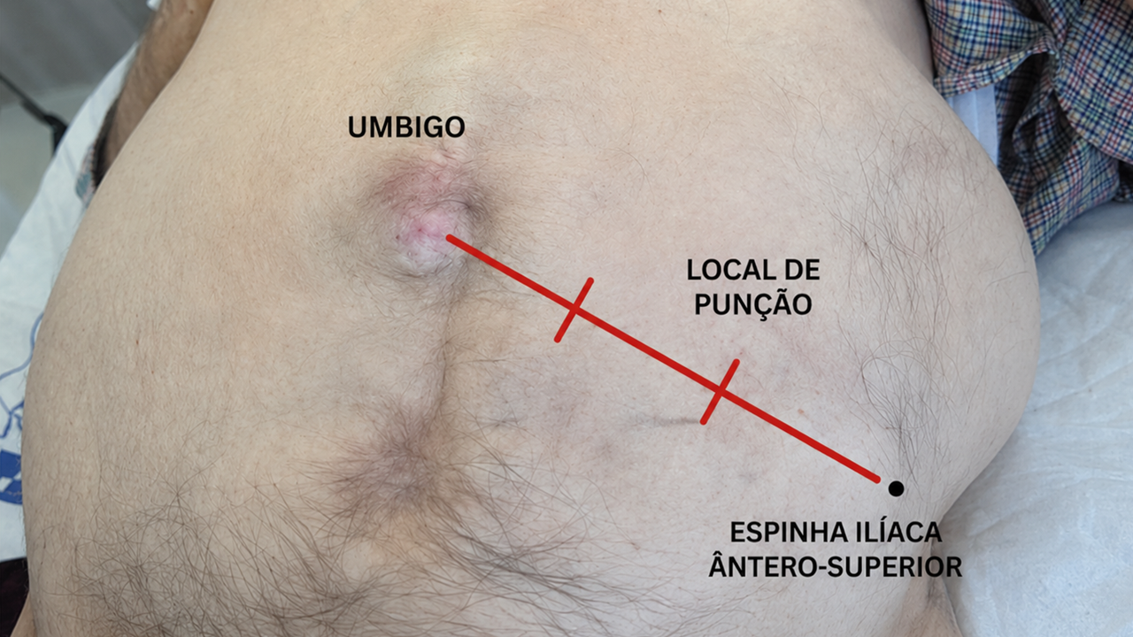 fig n par.png