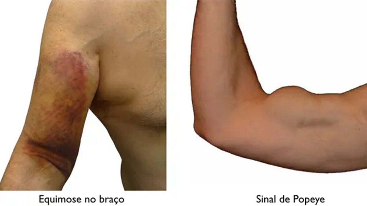 sinais m.png