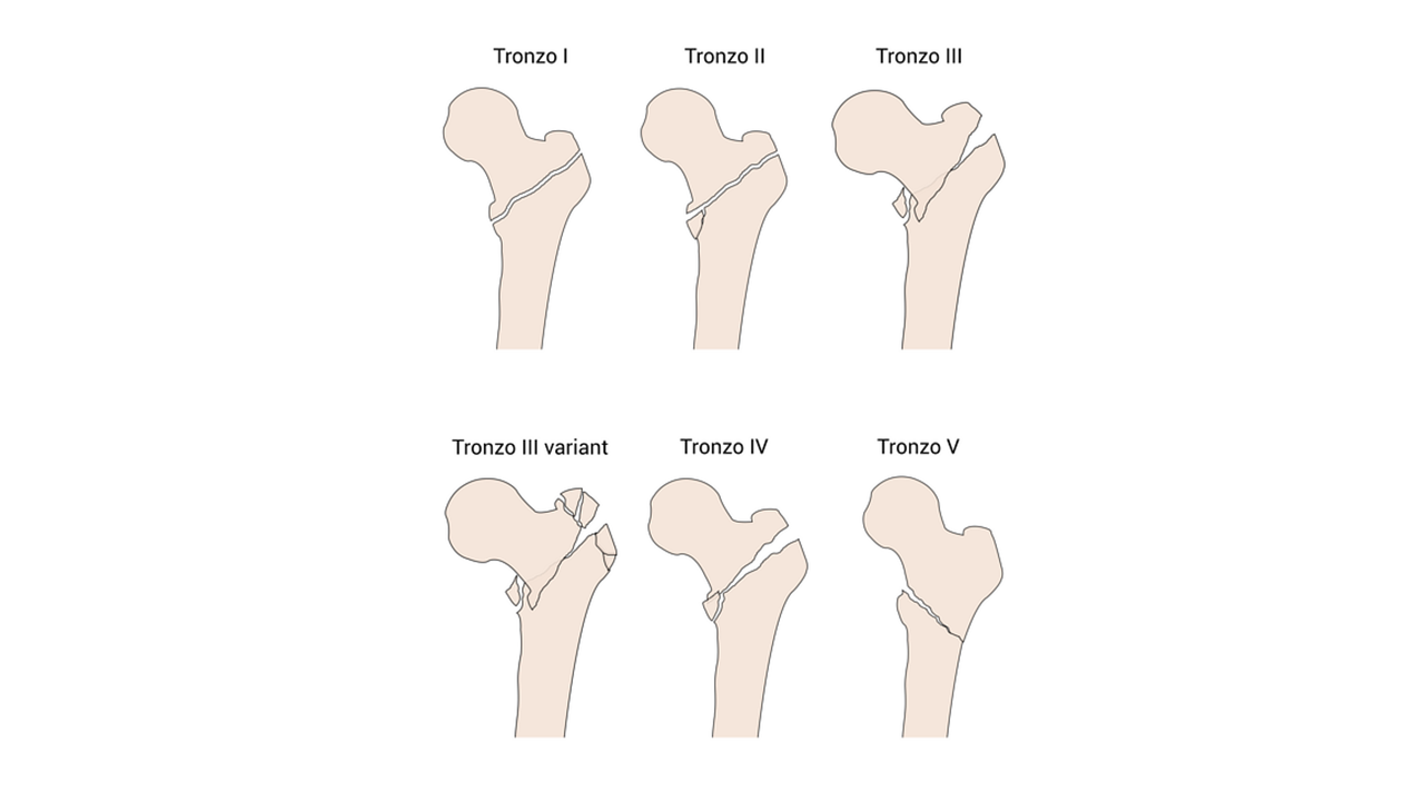 classificacao de troznzo1.png