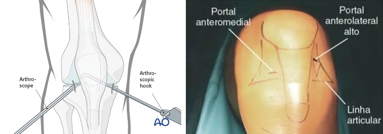 abordagem-artroscopia.jpg