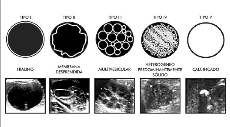 Figura-N-3-Comparacion-de-las-imagenes-ecograficas-de-las-clasificaciones-de-Gharbi-y.png