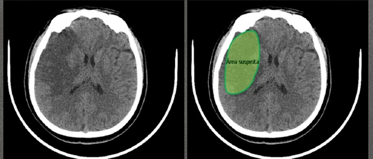 ave is sub.jpg ave is sub.jpg